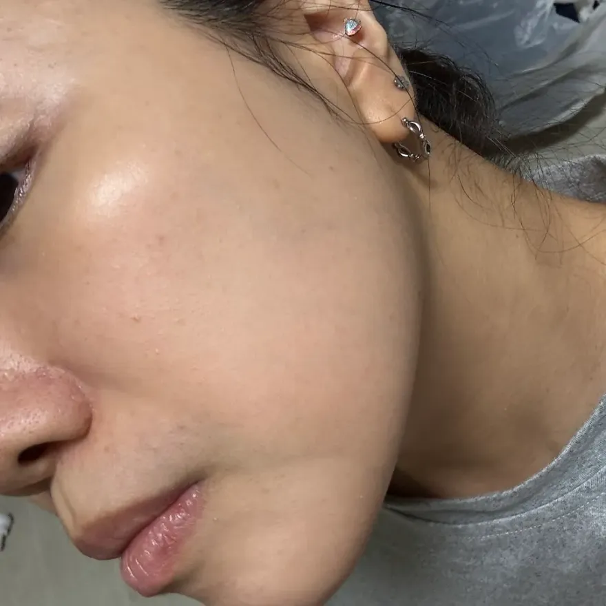 다이소 바세린 마스크팩 여름철 속건조 집중보습 후기 — 사진 15