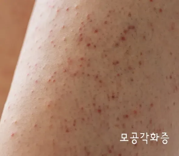 지오마 레몬라임 바디스크럽, 각질 제거와 촉촉함 후기 — 사진 4