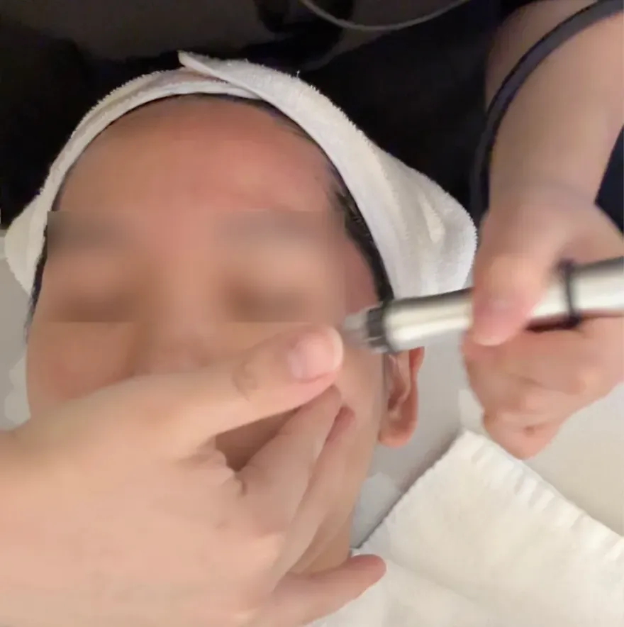 라라필 산소필 아쿠아필 비교: 모공·피지·건조 피부 타입별 필링 추천 — 사진 4