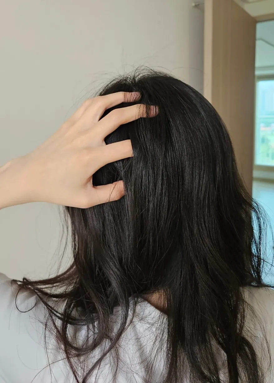 여름 지성 두피 샴푸 추천: 니옥신 스칼프 샴푸 후기 — 사진 2