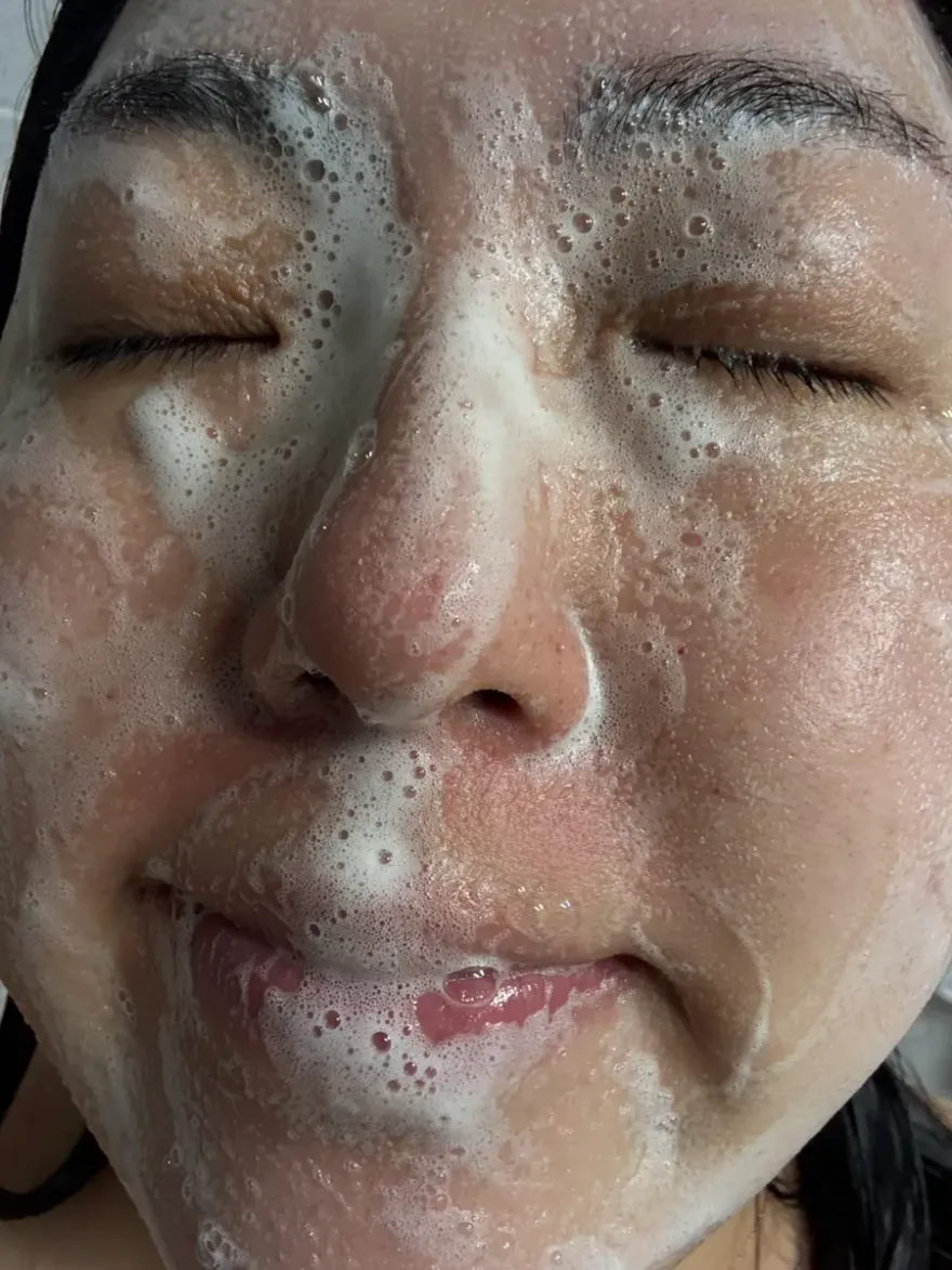 아우페 약산성 토마토 버블 폼클렌징, 촉촉한 마무리감 — 사진 15