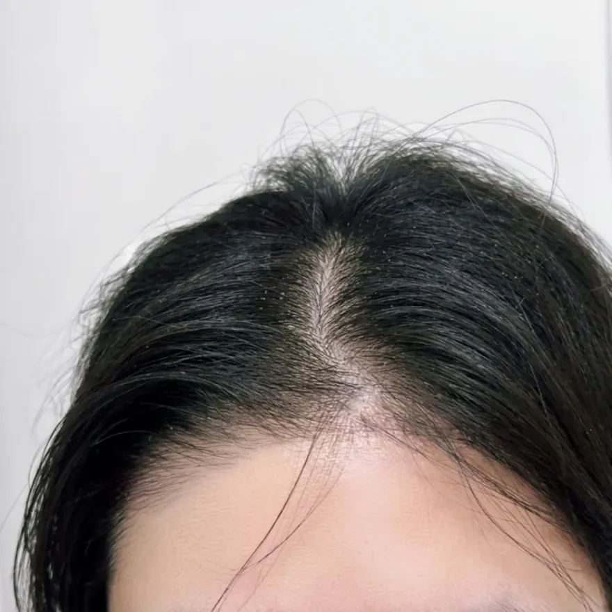 레이티드그린 샴푸, 건성 두피 각질 가려움 완화 후기 — 사진 2
