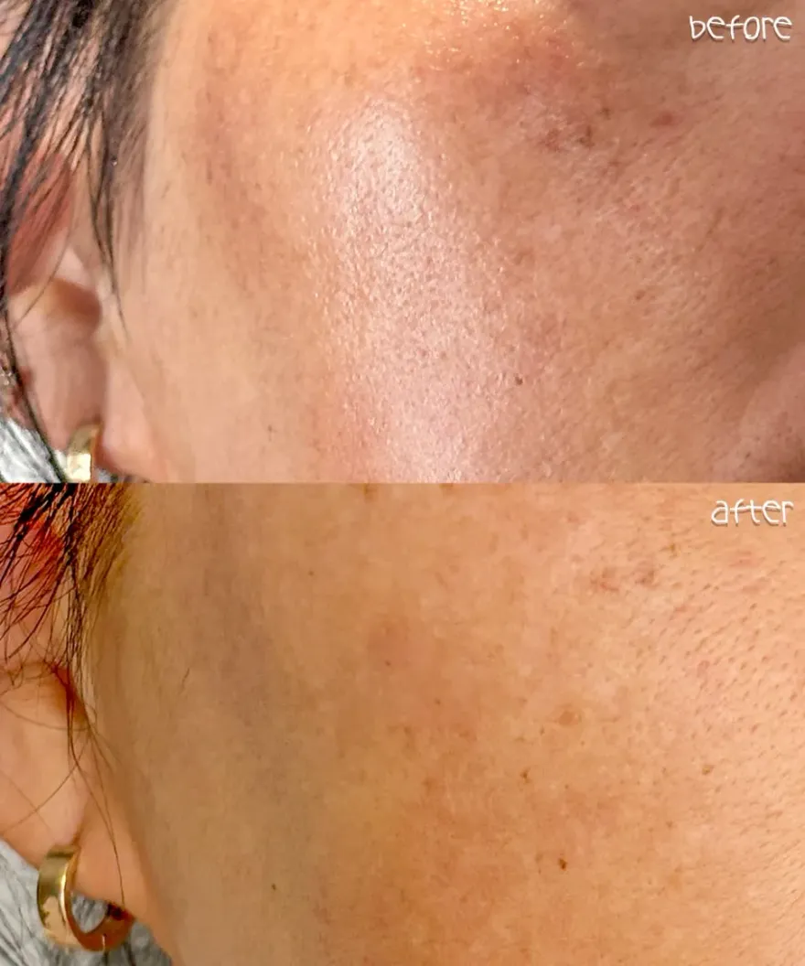 민감성 커런트바디 LED 마스크, 한 달 사용 후 탄력·붉은기 개선 후기