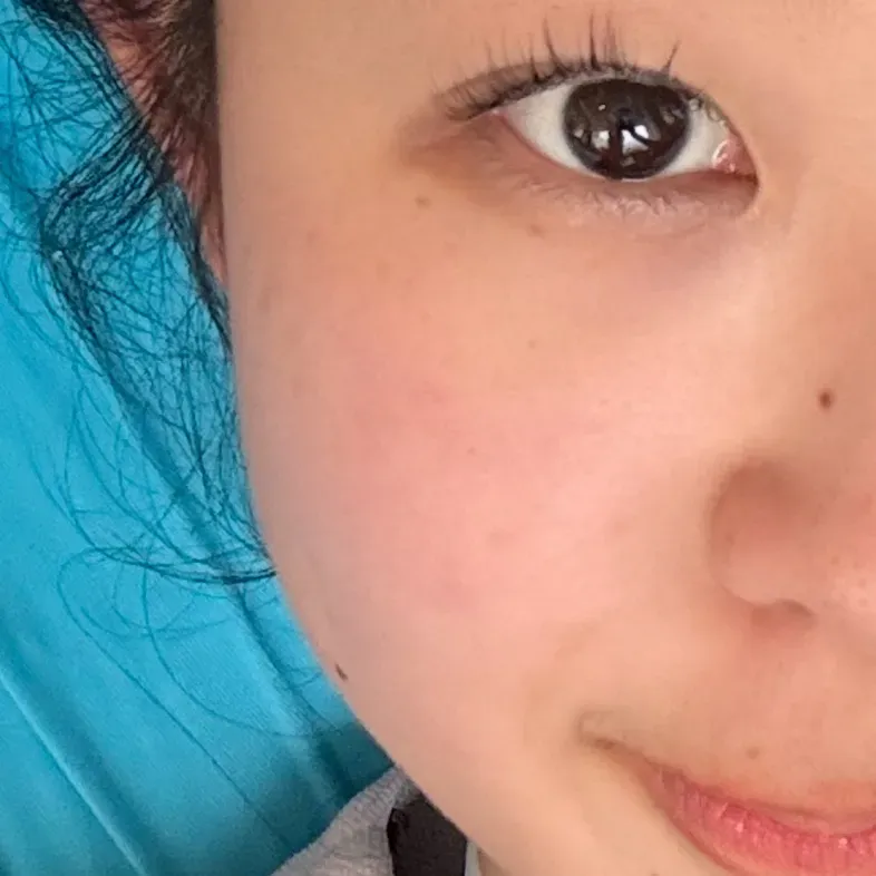 아비브 히알루로닉 붐 세럼, 악건성 피부 열감 케어 후기 — 사진 2