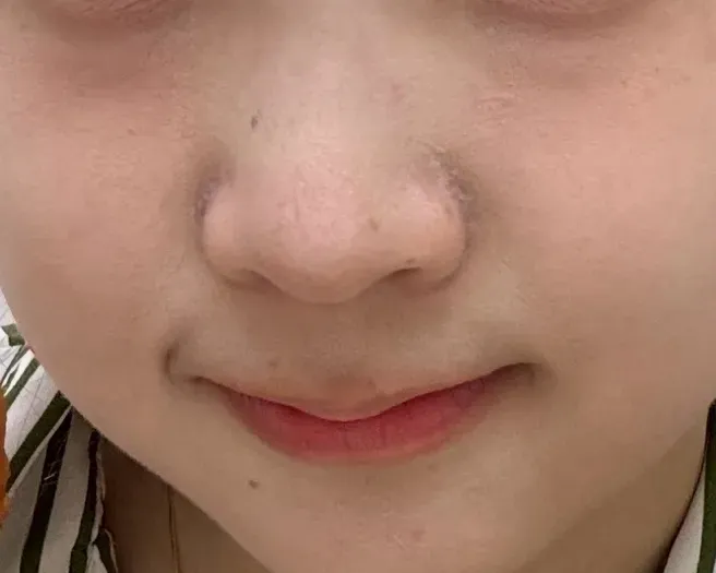 아비브 히알루로닉 붐 세럼, 악건성 피부 열감 케어 후기 — 사진 3